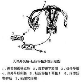 体外受精图册_360百科